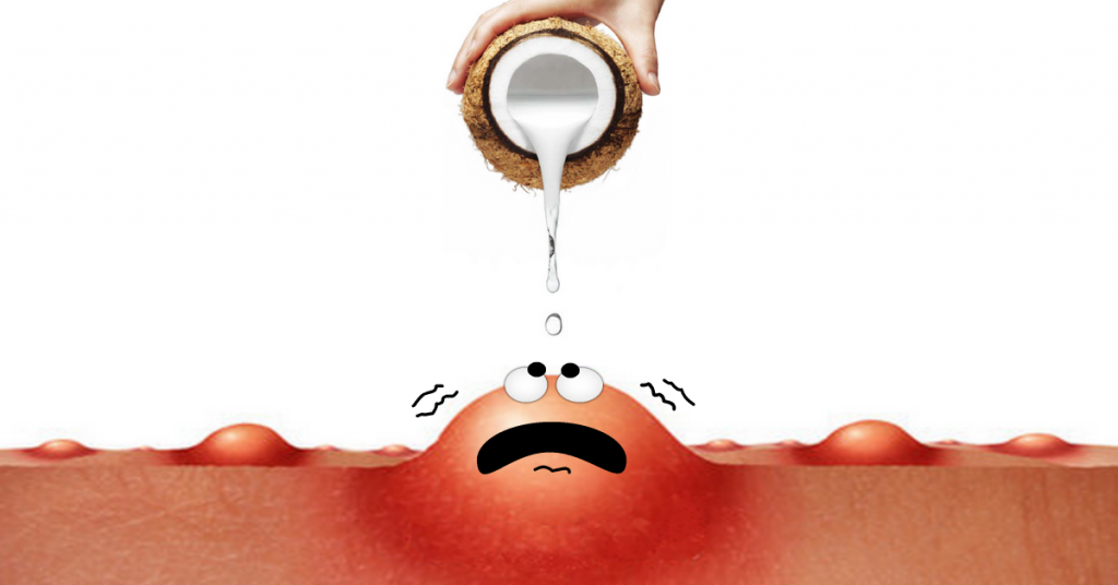 Hand pouring coconut oil over a large pimple that shivers with fear